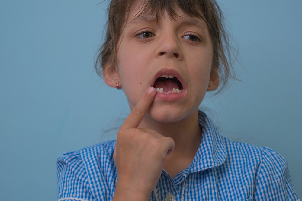 child with knocked out tooth